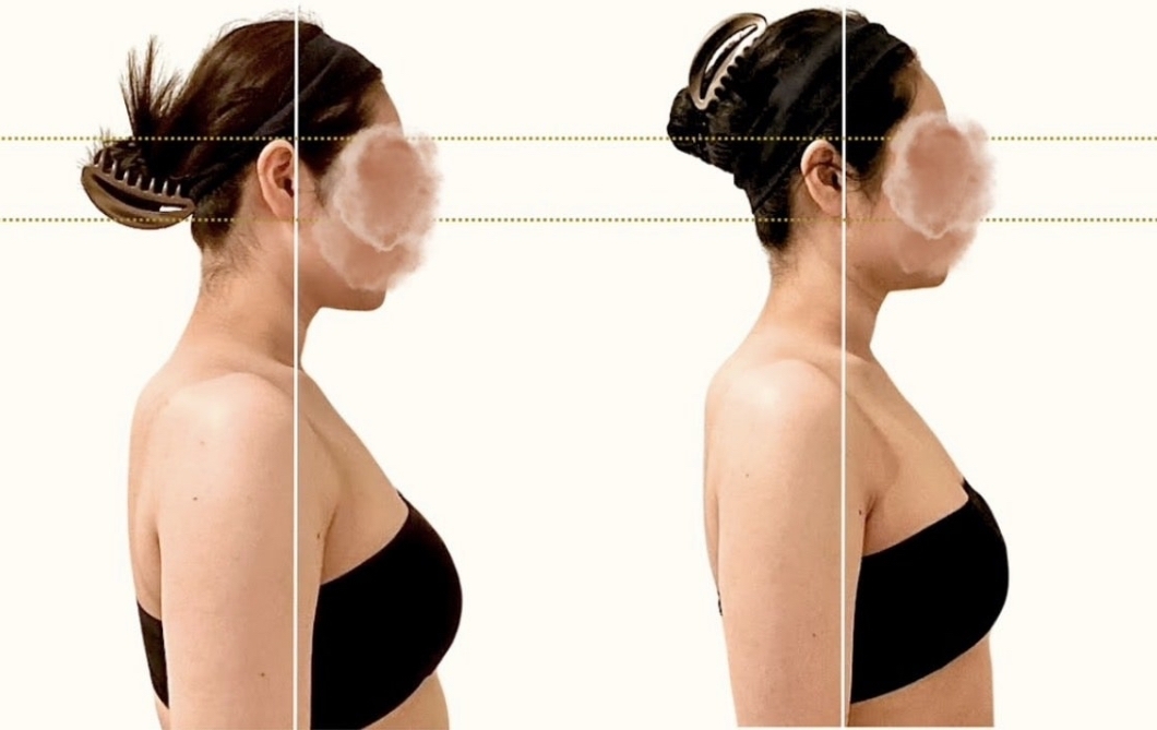 美禅の施術前後の画像