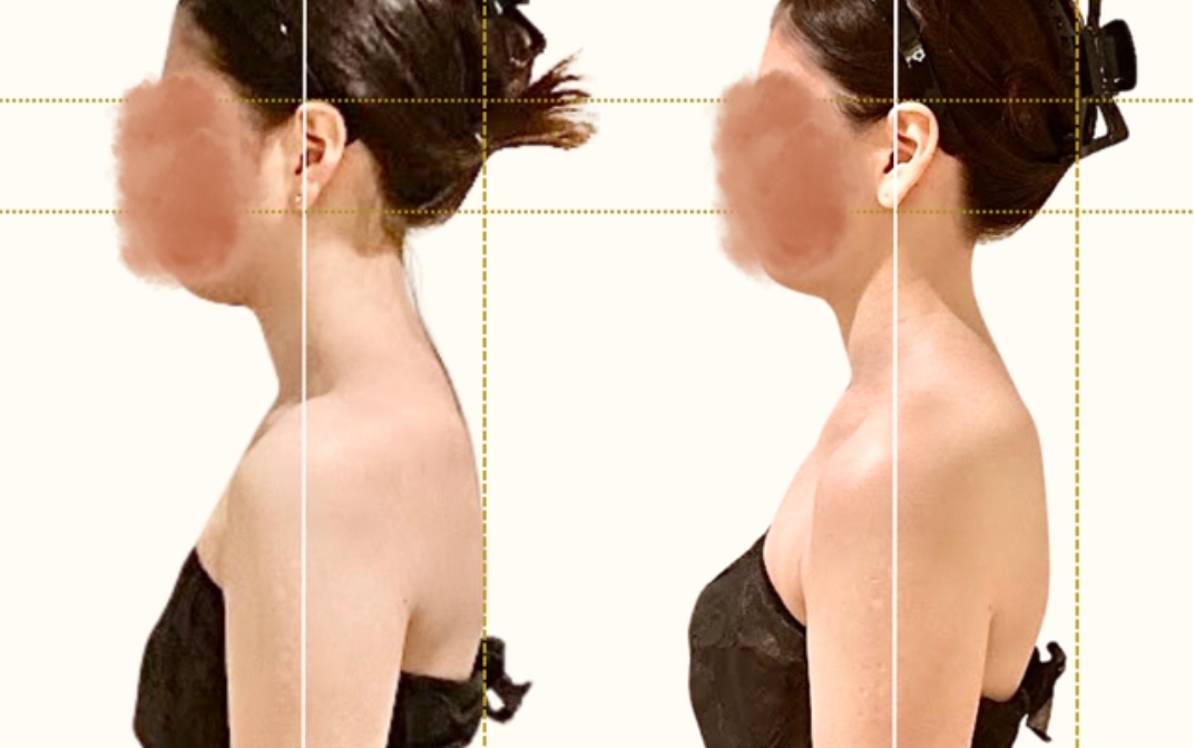 美禅の施術前後の画像