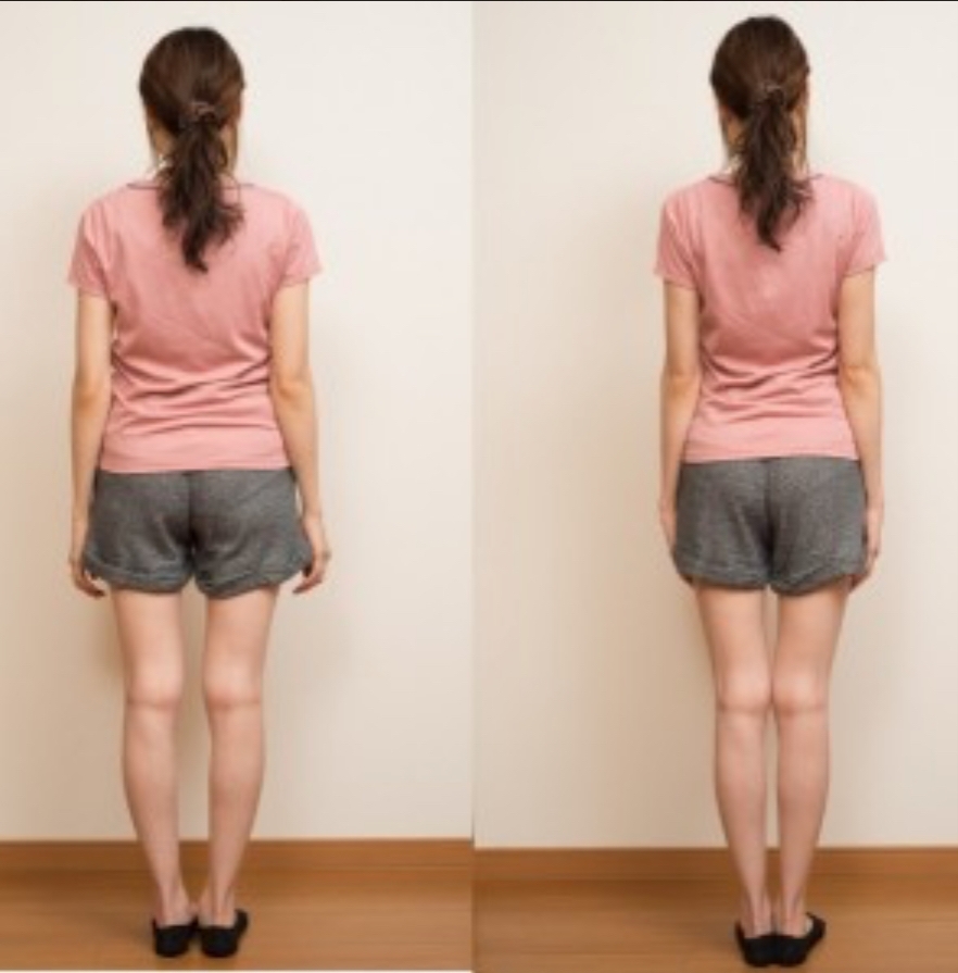 美禅の施術前後の画像