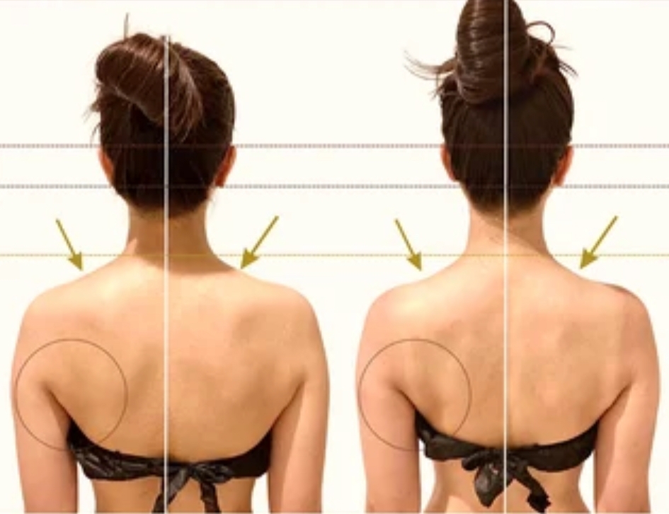 美禅の施術前後の画像